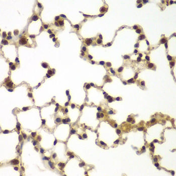 ChIP Antibodies Anti-SULT2B1 Antibody CAB7736