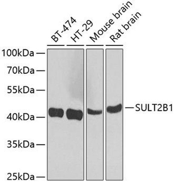 ChIP Antibodies Anti-SULT2B1 Antibody CAB7736