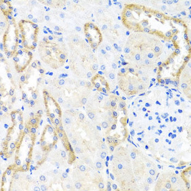 Cell Biology Antibodies 11 Anti-BSND Antibody CAB7747