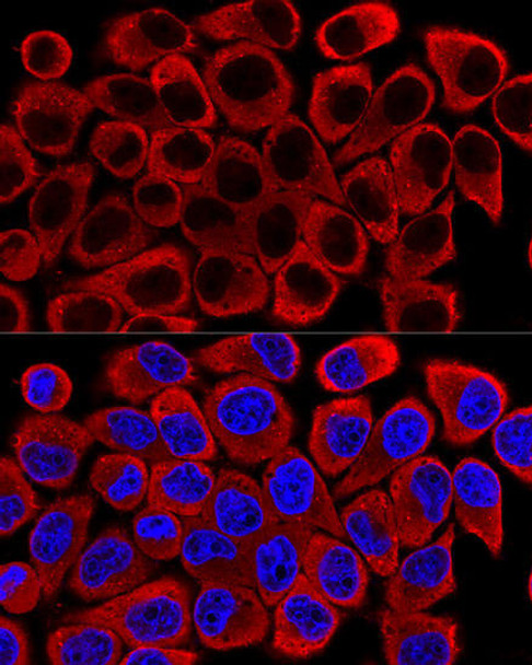 Cell Death Antibodies 2 Anti-SQSTM1 / p62 Antibody CAB7758