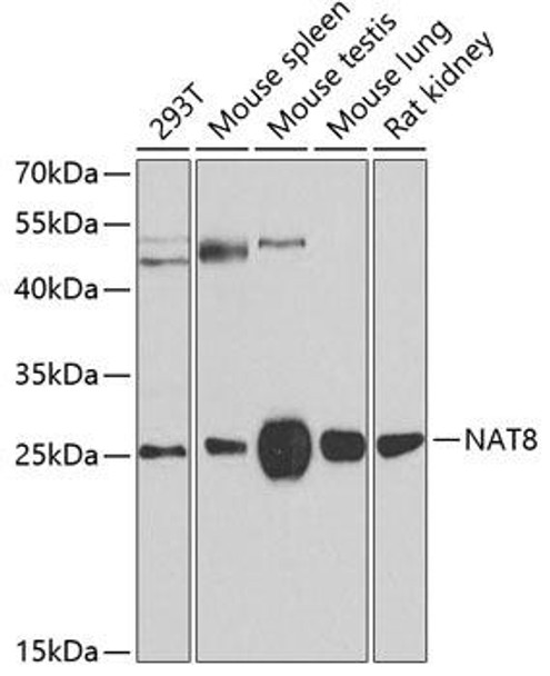 Cell Biology Antibodies 11 Anti-NAT8 Antibody CAB7759
