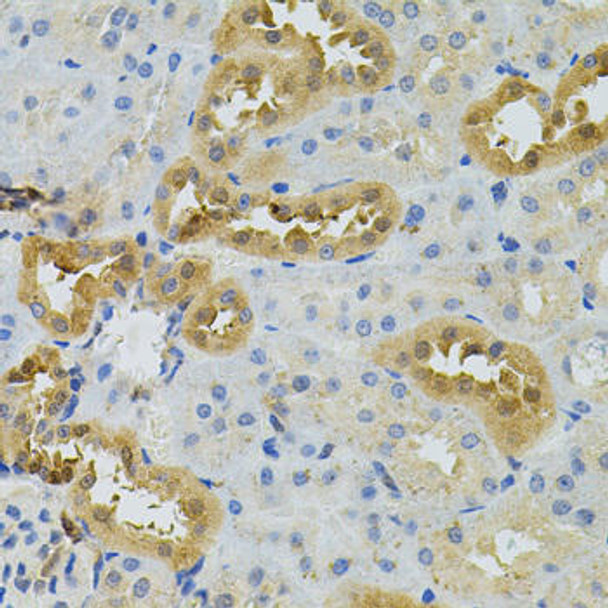 Cell Biology Antibodies 11 Anti-NAT8 Antibody CAB7759