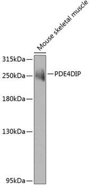 Cell Biology Antibodies 11 Anti-PDE4DIP Antibody CAB7765