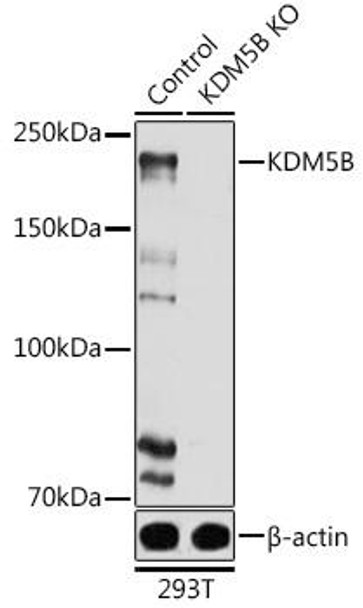 KO Validated Antibodies 1 Anti-KDM5B Antibody CAB7772KO Validated