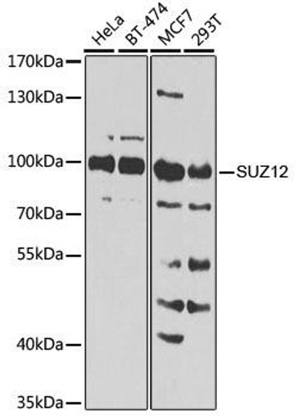 KO Validated Antibodies 1 Anti-SUZ12 Antibody CAB7786KO Validated