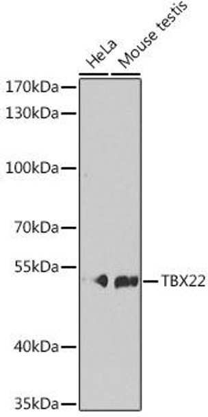 Epigenetics and Nuclear Signaling Antibodies 4 Anti-TBX22 Antibody CAB7801