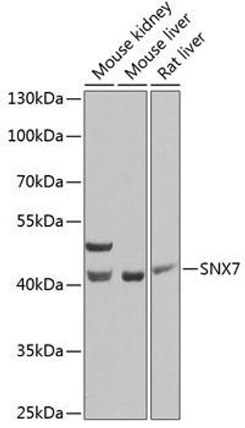 Cell Biology Antibodies 11 Anti-SNX7 Antibody CAB7805