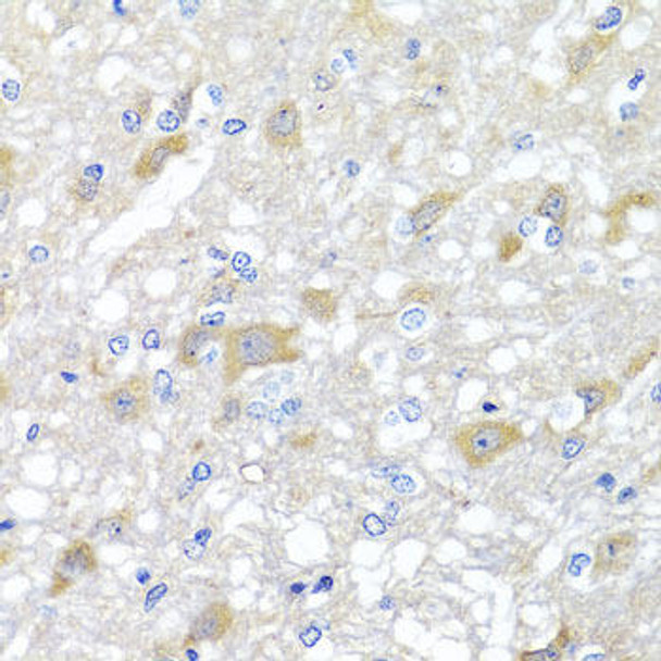 Cell Biology Antibodies 11 Anti-INPP5K Antibody CAB7807