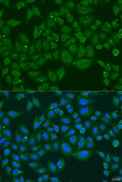 Cell Biology Antibodies 11 Anti-INPP5K Antibody CAB7807