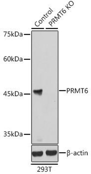 KO Validated Antibodies 1 Anti-PRMT6 Antibody CAB7814KO Validated