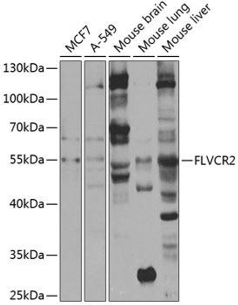 Signal Transduction Antibodies 3 Anti-FLVCR2 Antibody CAB7815
