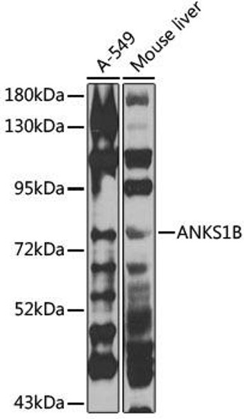 Cell Biology Antibodies 11 Anti-ANKS1B Antibody CAB7820