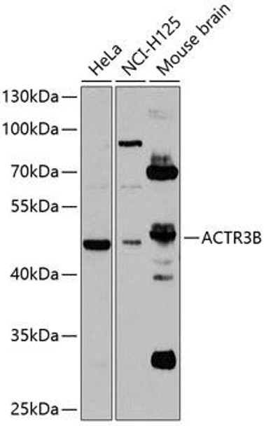 Cell Biology Antibodies 11 Anti-ACTR3B Antibody CAB7824