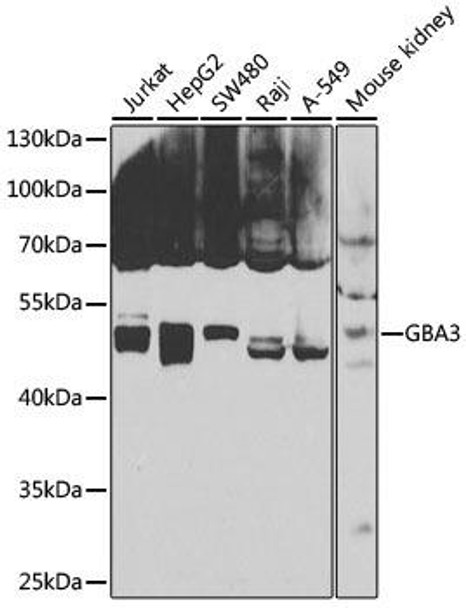 Cell Biology Antibodies 11 Anti-GBA3 Antibody CAB7827