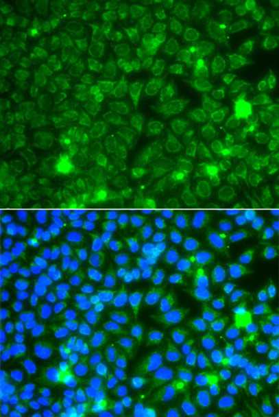 Cell Biology Antibodies 11 Anti-GBA3 Antibody CAB7827