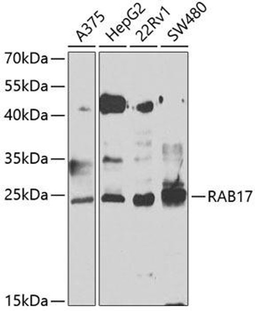 Cell Biology Antibodies 11 Anti-RAB17 Antibody CAB7831