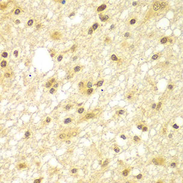 Epigenetics and Nuclear Signaling Antibodies 4 Anti-TBL1XR1 Antibody CAB7834