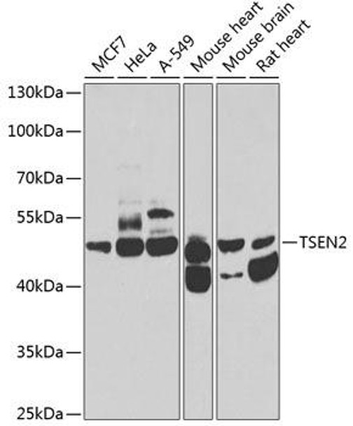 Epigenetics and Nuclear Signaling Antibodies 4 Anti-TSEN2 Antibody CAB7838