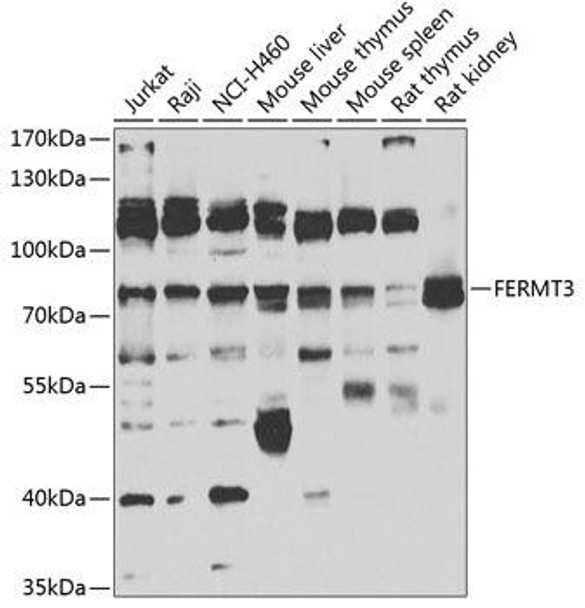 Cell Biology Antibodies 11 Anti-FERMT3 Antibody CAB7839