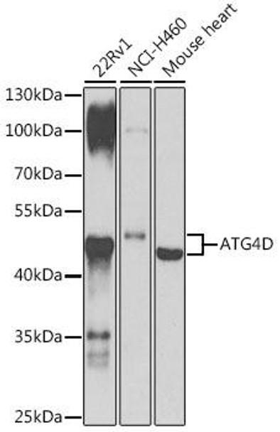 Cell Death Antibodies 2 Anti-ATG4D Antibody CAB7842