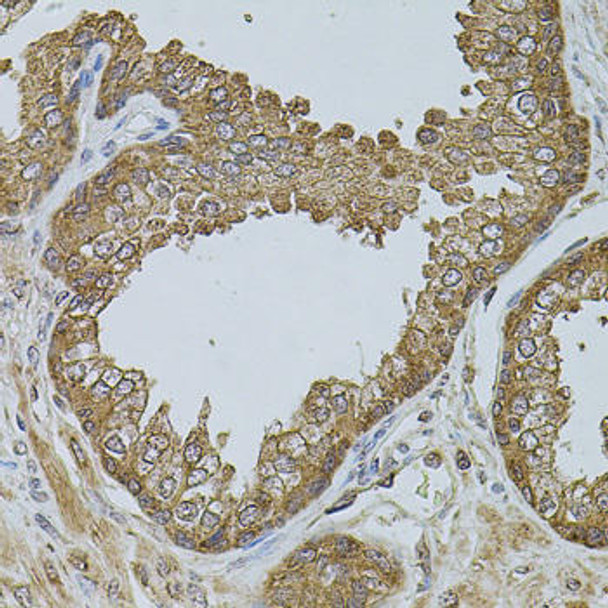 Cell Biology Antibodies 11 Anti-CHRFAM7A Antibody CAB7844