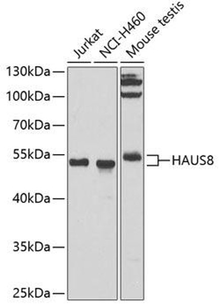 Cell Cycle Antibodies 2 Anti-HAUS8 Antibody CAB7847