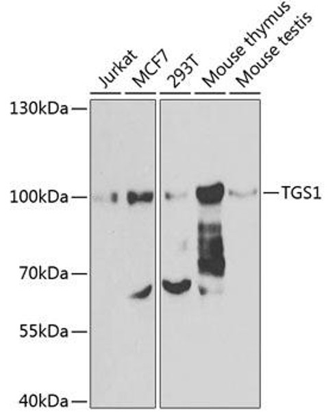 Epigenetics and Nuclear Signaling Antibodies 4 Anti-TGS1 Antibody CAB7848