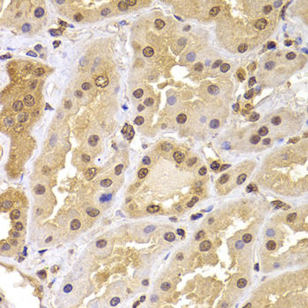 Cell Biology Antibodies 11 Anti-PHF21B Antibody CAB7849