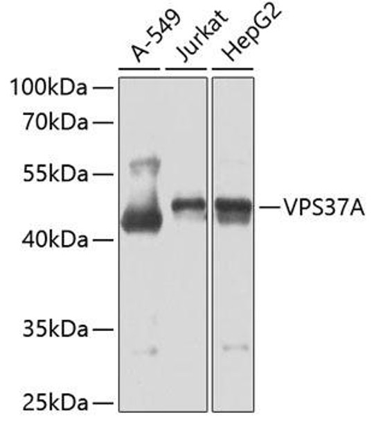 Cell Biology Antibodies 11 Anti-VPS37A Antibody CAB7853