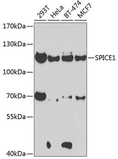 Cell Cycle Antibodies 2 Anti-SPICE1 Antibody CAB7855