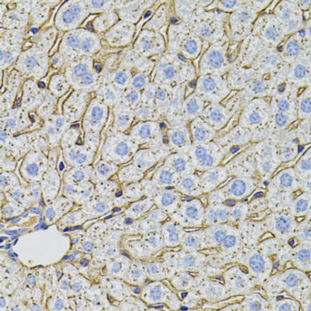 Cell Death Antibodies 2 Anti-PCSK9 Antibody CAB7860