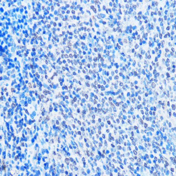 Immunology Antibodies 2 Anti-ADAR Antibody CAB7869