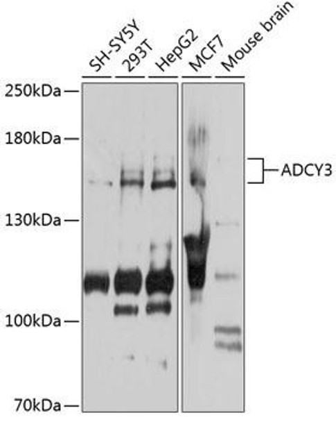 Metabolism Antibodies 2 Anti-ADCY3 Antibody CAB7870