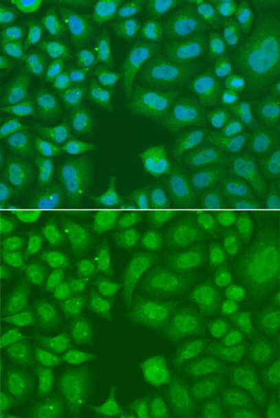 Epigenetics and Nuclear Signaling Antibodies 4 Anti-AES Antibody CAB7874