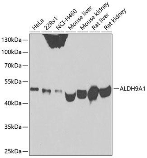 Cell Biology Antibodies 11 Anti-ALDH9A1 Antibody CAB7875