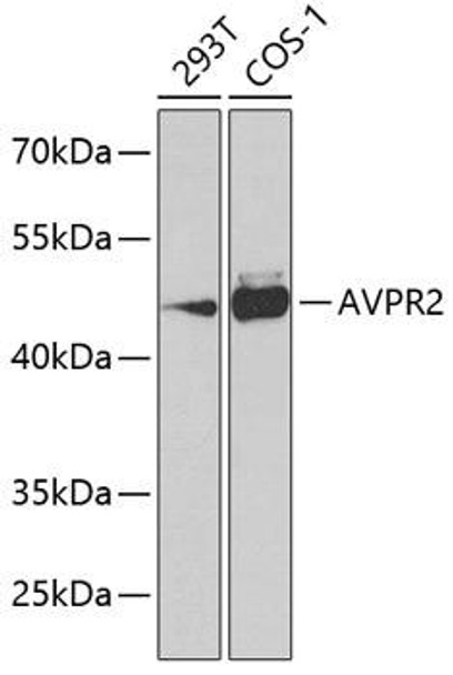 Cell Biology Antibodies 11 Anti-AVPR2 Antibody CAB7879