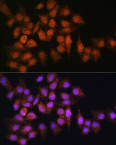 Metabolism Antibodies 2 Anti-BPGM Antibody CAB7880