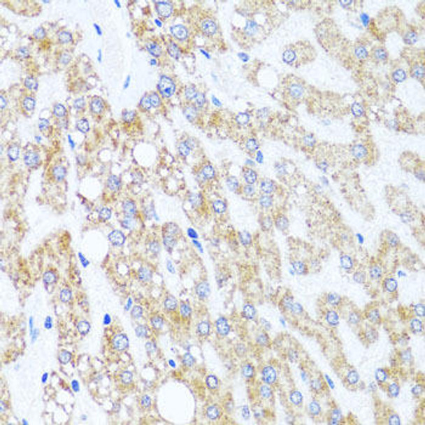 KO Validated Antibodies 1 Anti-CHD1 Antibody CAB7883KO Validated