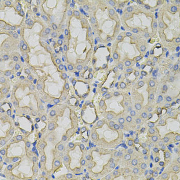 Autophagy Antibodies Anti-CLTC Antibody CAB7886