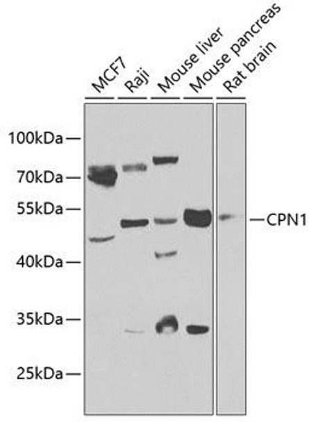 Cell Biology Antibodies 11 Anti-CPN1 Antibody CAB7887
