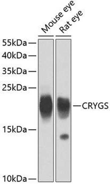 Cell Biology Antibodies 11 Anti-CRYGS Antibody CAB7888
