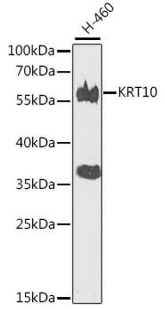 Cell Biology Antibodies 11 Anti-KRT10 Antibody CAB7908