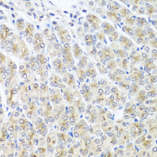 Cell Biology Antibodies 11 Anti-MTX1 Antibody CAB7912