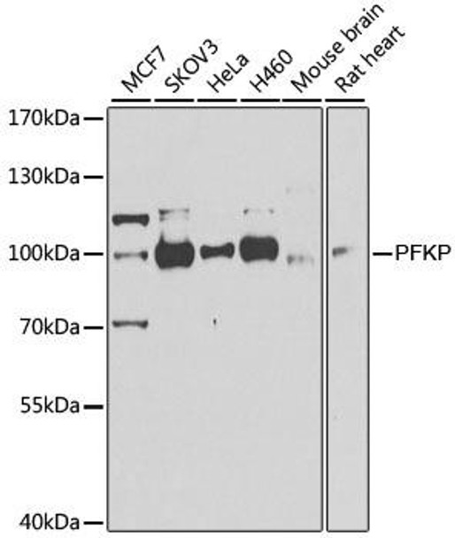 KO Validated Antibodies 1 Anti-PFKP Antibody CAB7916KO Validated
