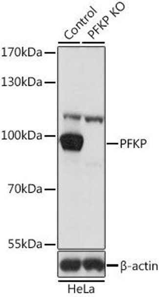 KO Validated Antibodies 1 Anti-PFKP Antibody CAB7916KO Validated