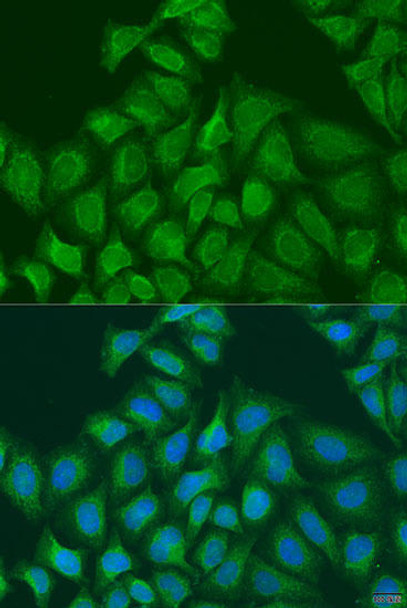 Cell Biology Antibodies 11 Anti-PLOD1 Antibody CAB7919