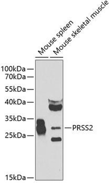 Cell Biology Antibodies 11 Anti-PRSS2 Antibody CAB7923