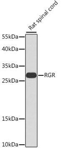 Signal Transduction Antibodies 3 Anti-RGR Antibody CAB7925
