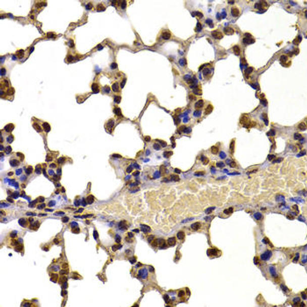 Epigenetics and Nuclear Signaling Antibodies 4 Anti-WHSC1 Antibody CAB7938