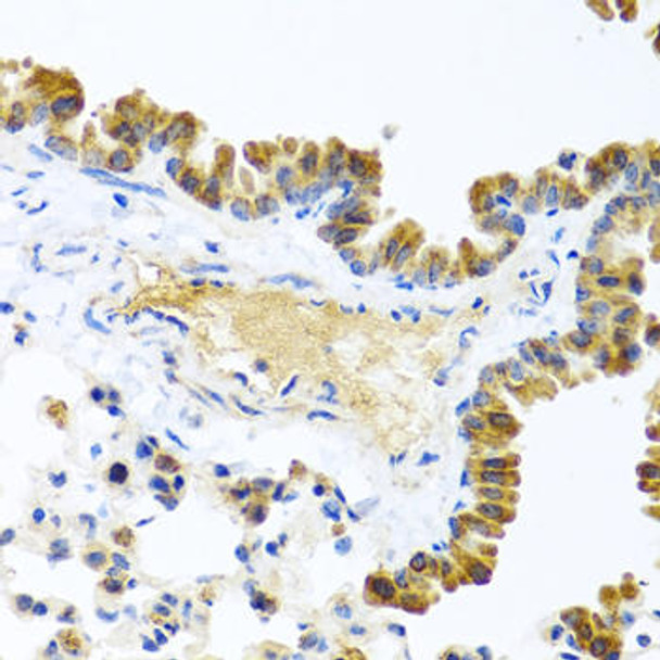 Metabolism Antibodies 2 Anti-WNT9A Antibody CAB7939